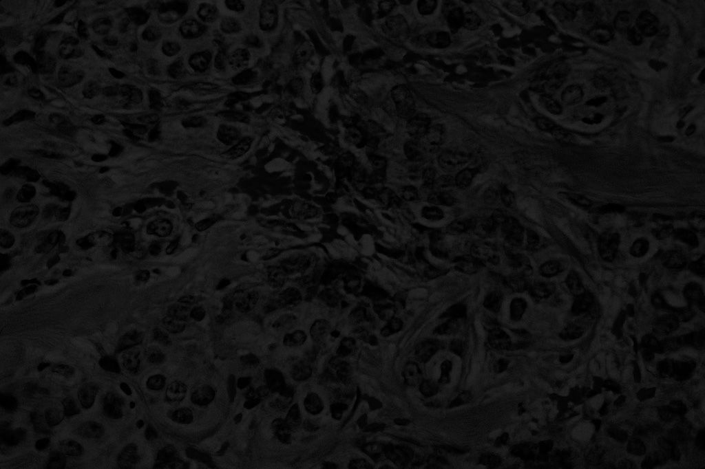 Cancer Cells